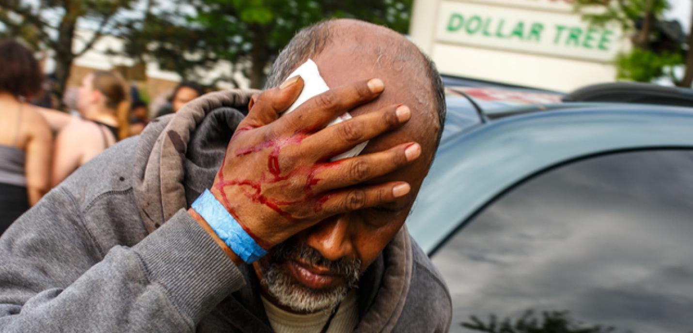 homme qui se cache les yeux après avoir reçu une balle en caoutchouc