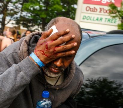 homme qui se cache les yeux après avoir reçu une balle en caoutchouc